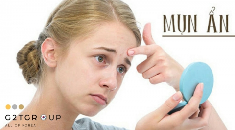 Những cách trị mụn ẩn hiệu quả cho phái đẹp 
